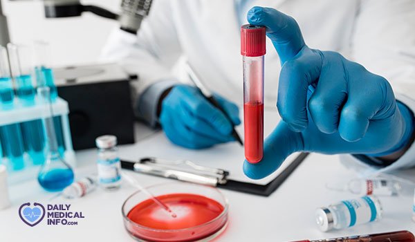 تعرف على فصيلة الدم AB بنوعيها الموجب والسالب وما تتميز به من خصائص فريدة تؤثر على صحتك وعمليات نقل الدم.